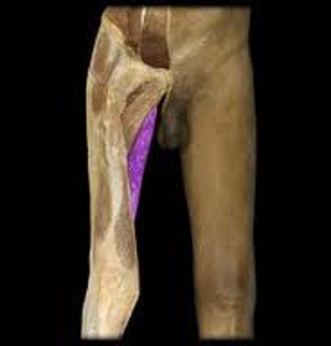 <p>abducts thigh</p>
