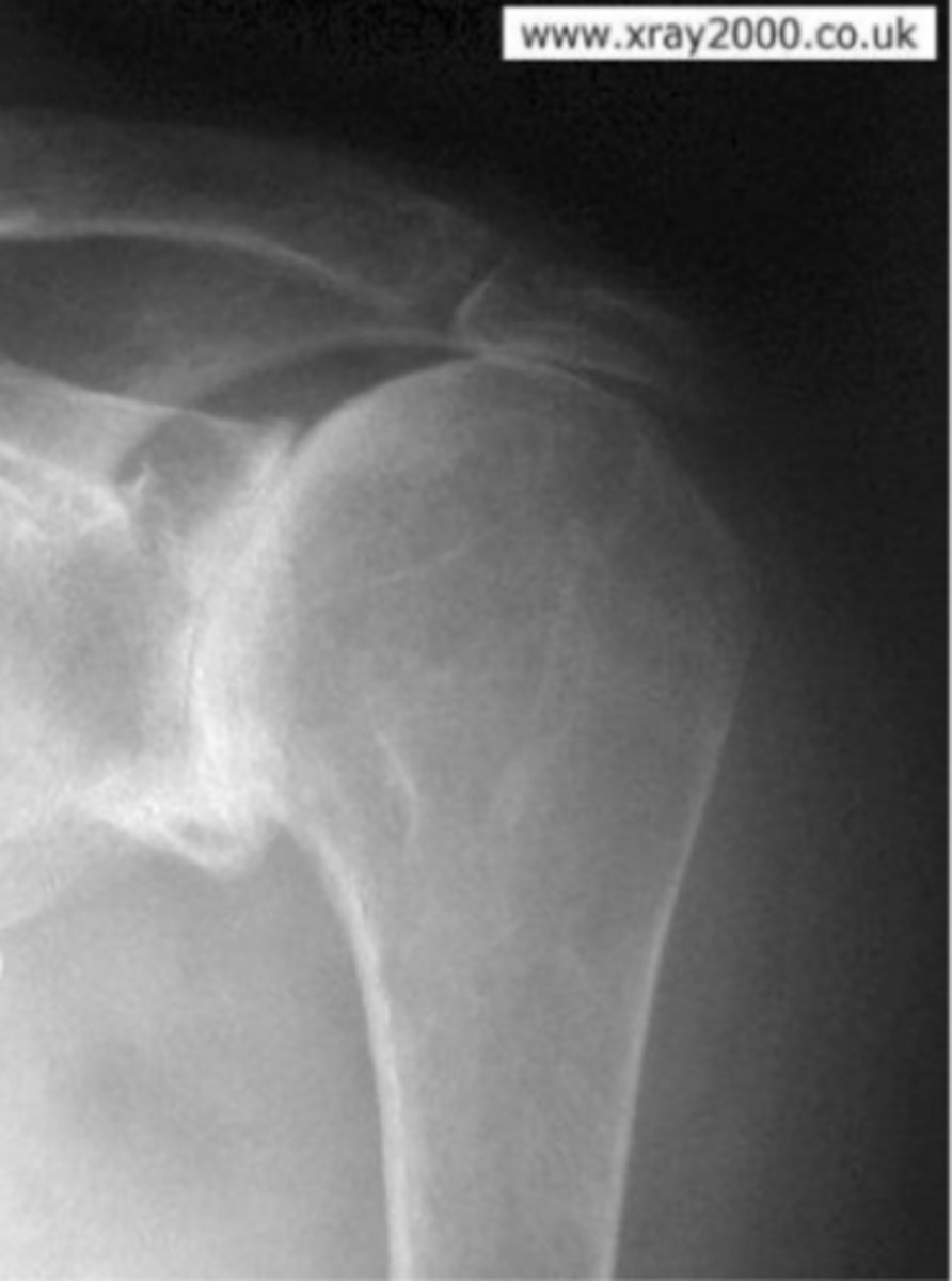 <p>What is the issue?</p>