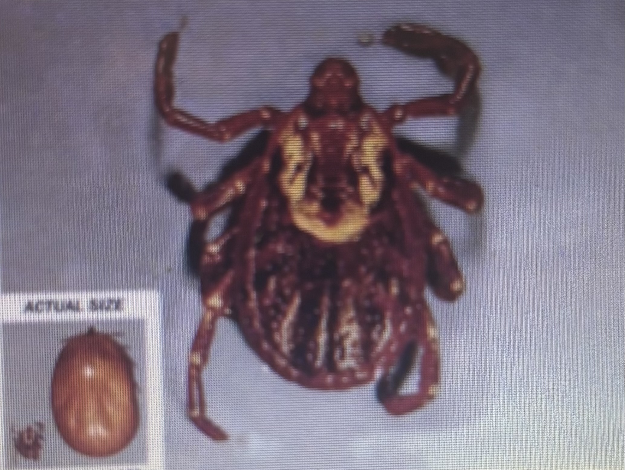 <p>Hard tick </p><p>Inhabits grassy scrub brush areas </p><p>American dog tick </p>