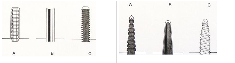 <ul><li><p>Parallel sided - A-Serrated (least retentive), B-Smooth, C-Threaded (most retentive)</p></li><li><p>Tapered side - A-Serrated (least retentive), B-Smooth, C-Threaded (most retentive)</p></li></ul><p></p><ul><li><p>longest possible post ensures that the forces transmitted from the crown are distributed over as much of the root as possible giving greater retentions.</p></li><li><p>appropriate diameter post ensures that as much natural tooth structure is left to support the post and absorb the transmitted forces.</p></li><li><p>parallel post ensures the greatest retention</p></li><li><p>smooth-surfaced post, although less retentive than either serrated or threaded post surfaces, transmits the least amount of force to the tooth structure.</p></li></ul><p></p>