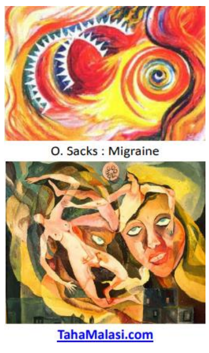 peuvent être élémentaires ou complexes :
✓ Elémentaires (phosphènes) : mouches volantes, points lumineux, « étoiles », flashes, formes géométriques, couleurs,… +- en mouvement.
✓ Complexes : personnes, animaux, scènes,…