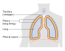<p>the area between the parietal and visceral pleurae; pleural fluid is excreted into this space</p>