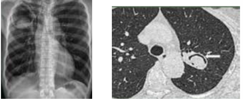 Air crescent sign or Monad sign