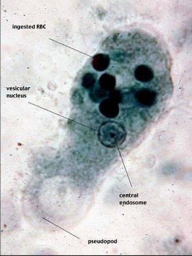 <p>E. histolyitca Trophozoites characteristically contain ___ during diagnostic test</p>
