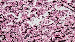 Type: loose 

Location: Spleen, Lymph nodes, liver

Function: provides space for lymphocytes