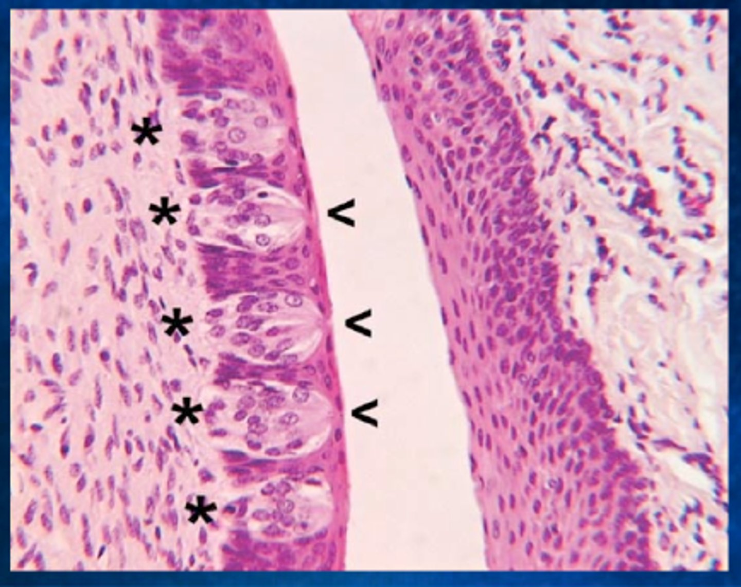 <p>Located on rounded projections on tongue, contains gustatory and other cells</p>