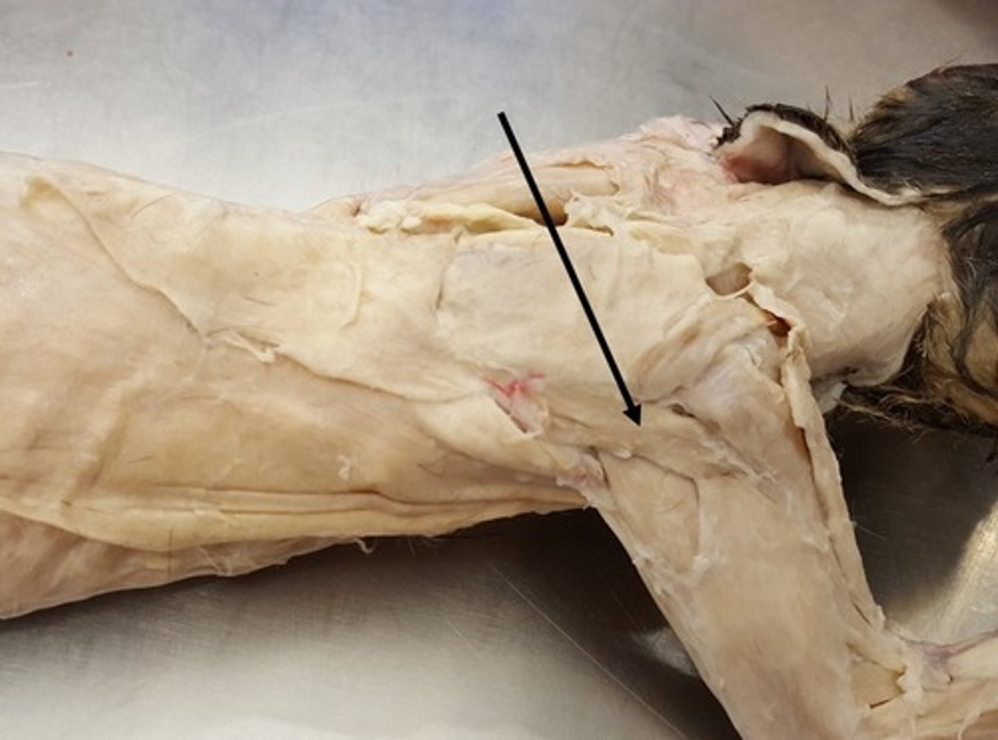 <p>name this muscle</p>