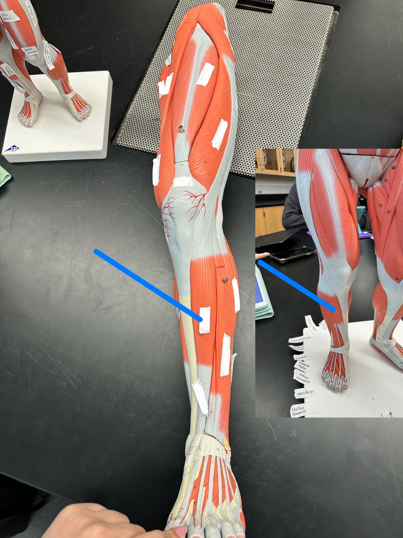 <p>ID muscle</p>