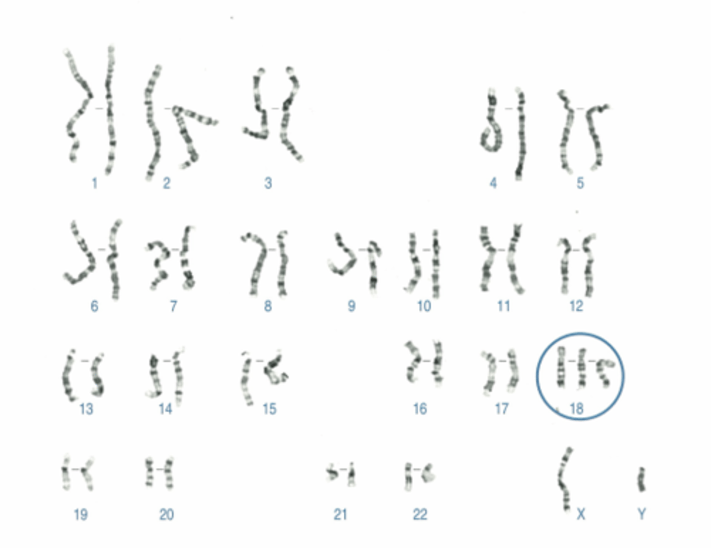 <p>Name:</p><p>- Correctly written karyotype</p><p>- Common name</p><p>- Scientific name</p><p>- One distinguishing clinical feature</p><p>- Definition of this feature if not obvious</p>