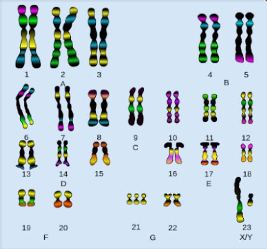 <p>Based on the karyotype, which of the statements below is true?</p>