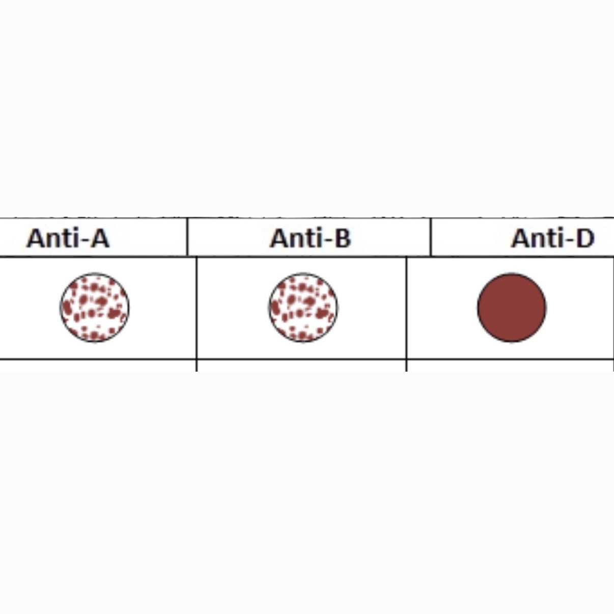 <p>What is this Blood Type? </p>
