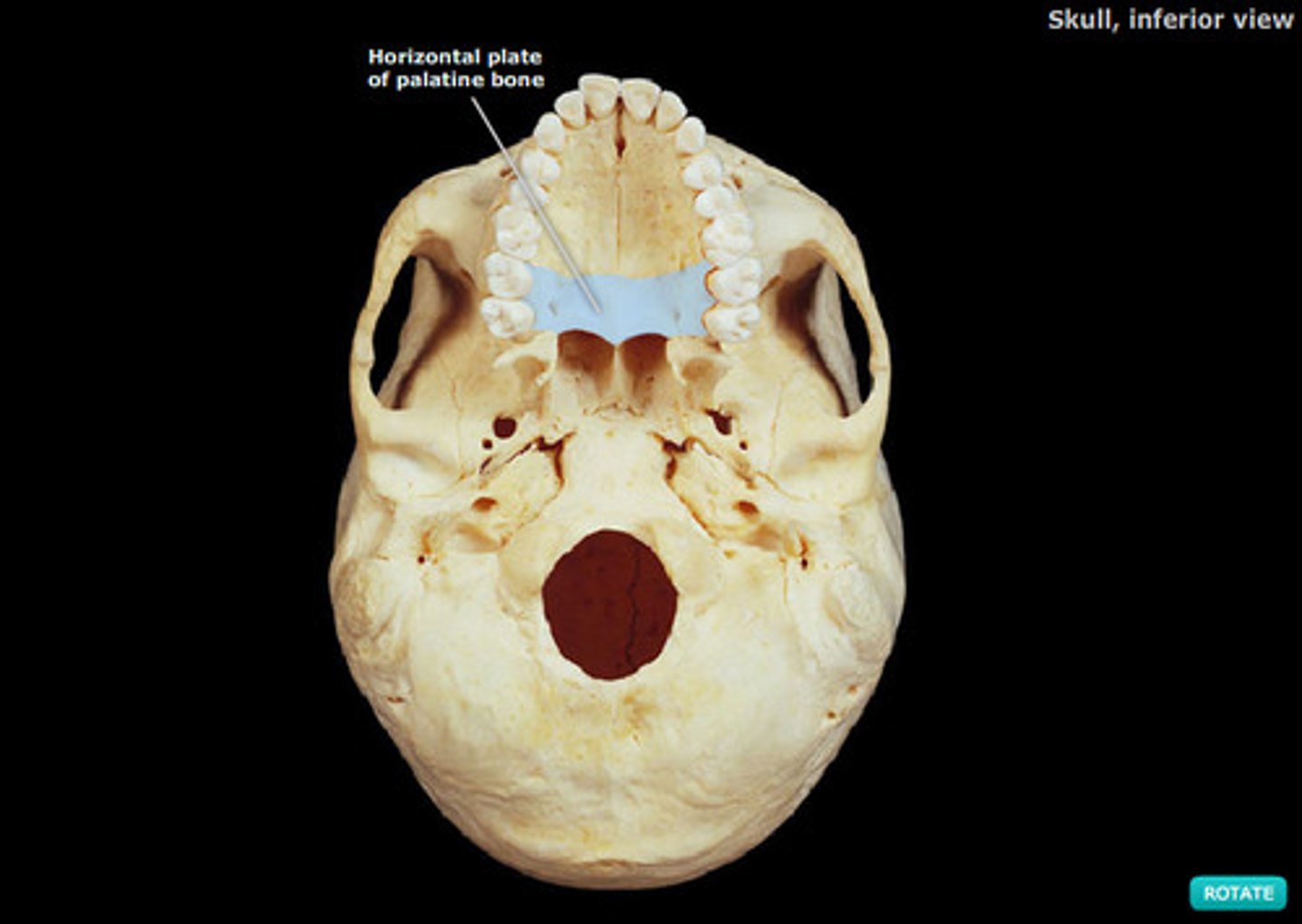 <p>(<strong>Inferior aspect of the skull, mandible removed)</strong></p>