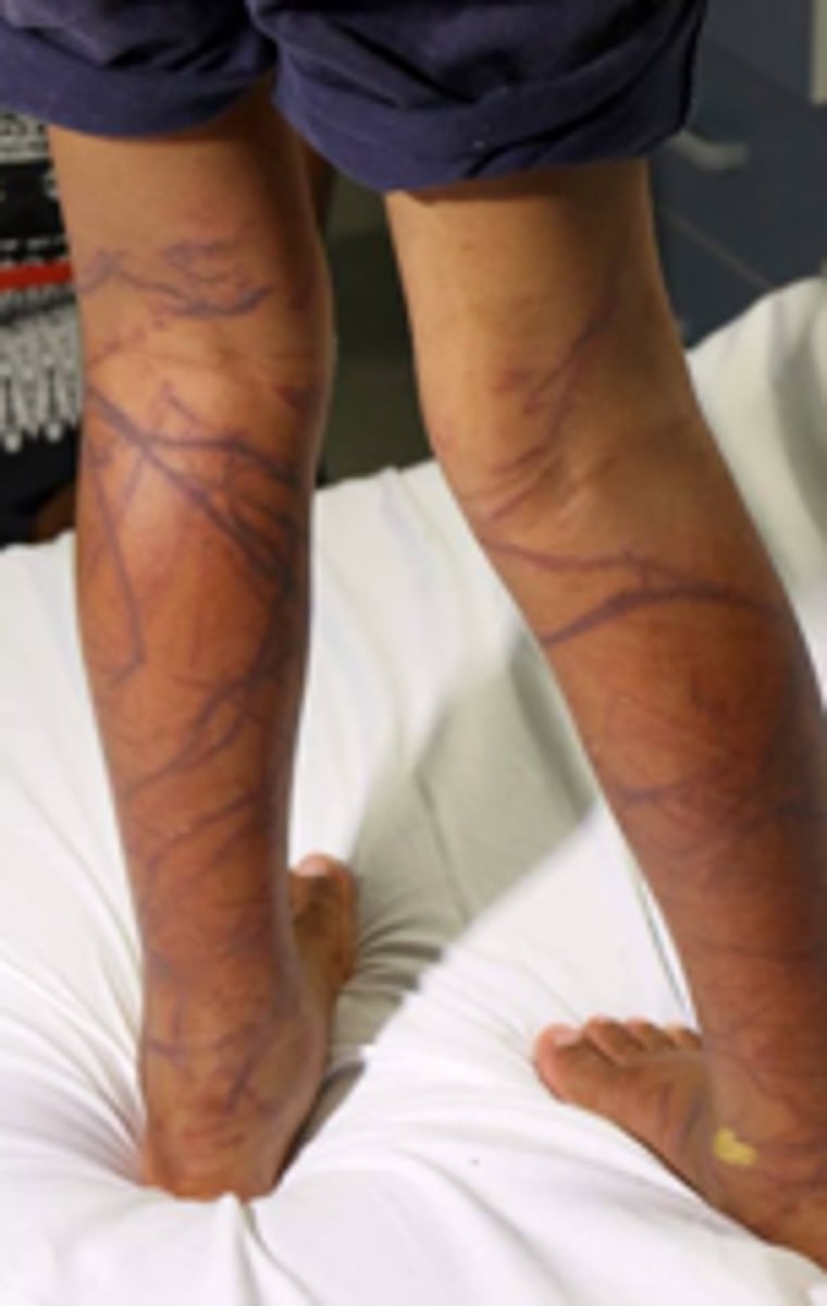 <p>highly venemous</p>