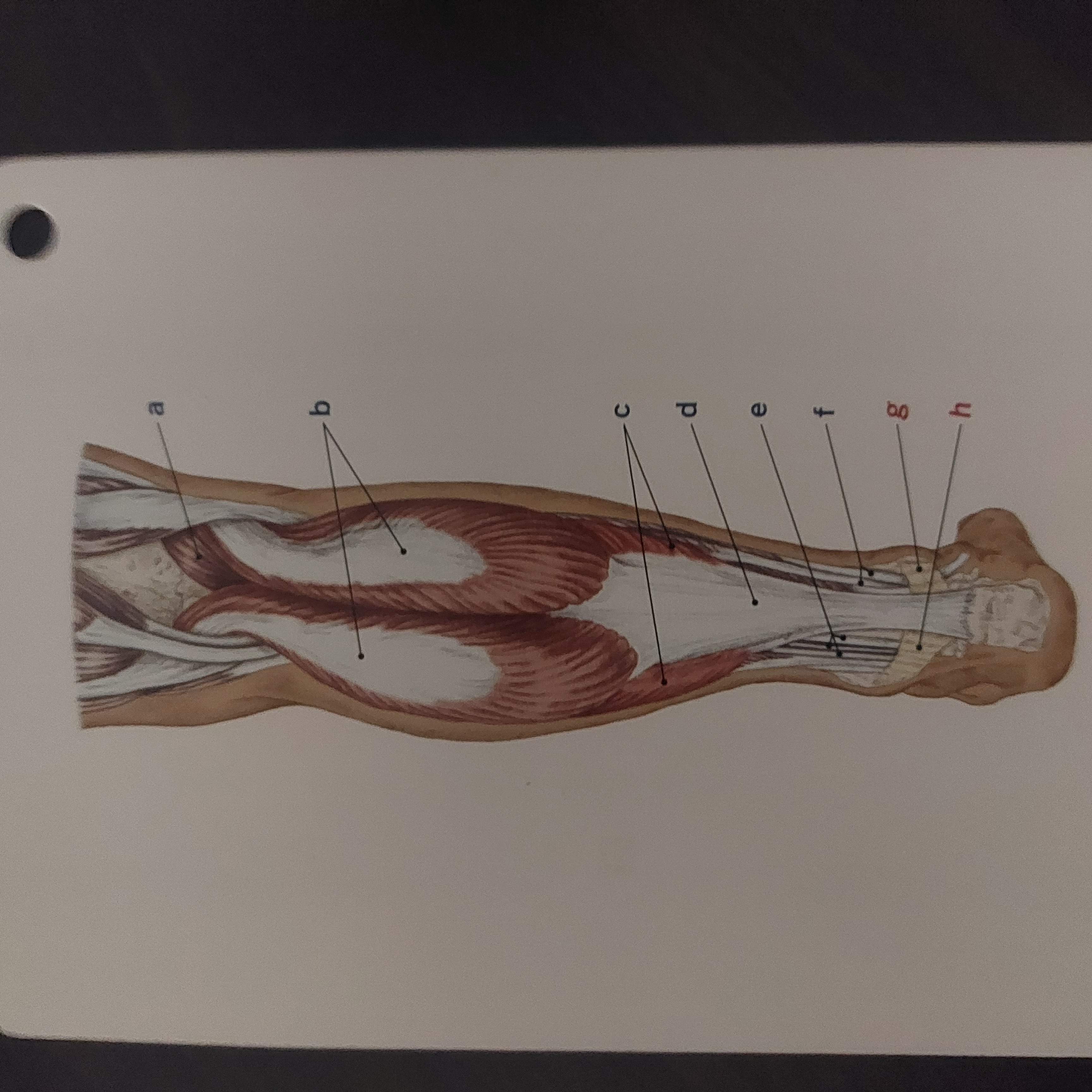 <p>Calcaneal tendon</p>