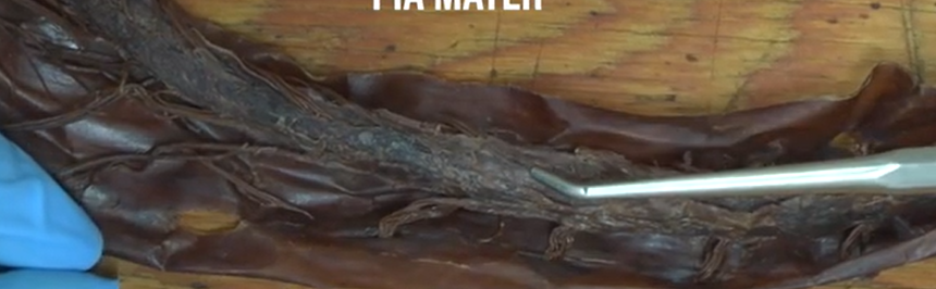 <p>The innermost layer of the meninges.</p>