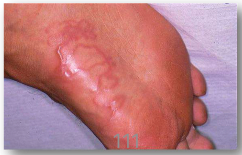 <p>Disease; caused by?</p>