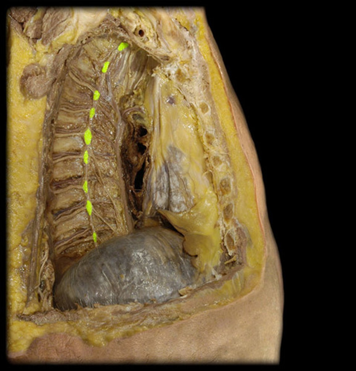 <p><em>identify the structure</em></p>