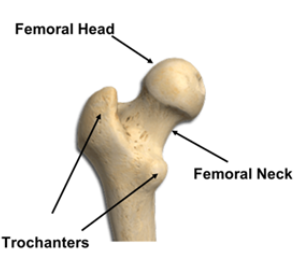 Location: Rounded end of the thigh bone (femur) at the hip joint.