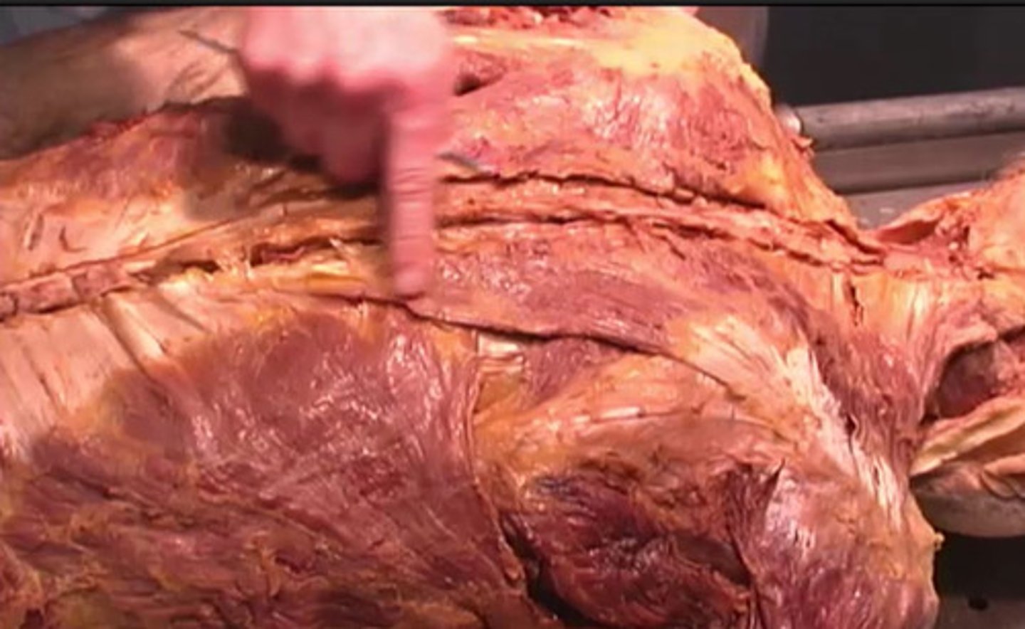 <p>What structure is being shown here?</p><p>epidermis</p><p>pectoralis major</p><p>trapezius</p><p>lateral spiine</p>