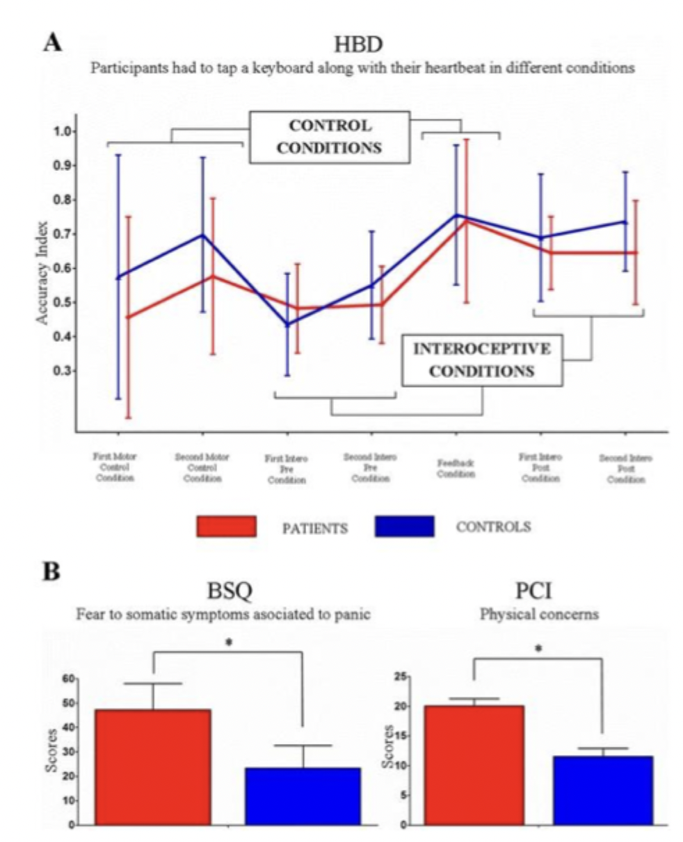 <ul><li><p>no difference in interoceptive accuracy</p></li><li><p>but difference in metacognition (threatening beliefs about the body)</p></li><li><p>not the detection of symptoms different to controls but how they are interpreted</p></li></ul><p></p>