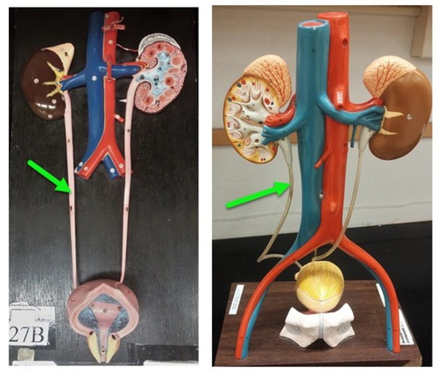 <p>tube that carries urine from the kidney to the urinary bladder</p>