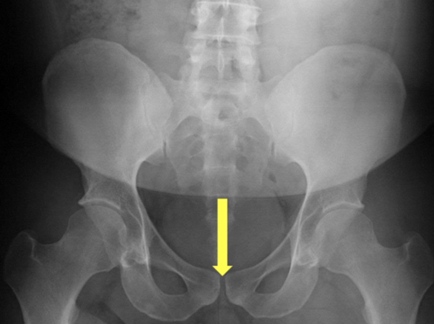 <p>What is the yellow arrow pointing to?</p>