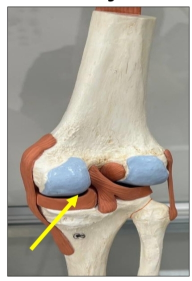 <p>identify this joint </p><p>mention the type of this joint according to the number of articulating bones </p><p>mention the type of this joint according to the shape of the articulating bones</p>