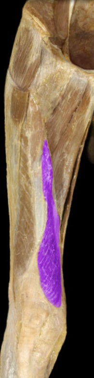 <p>Name the muscle highlighted (two words - all lowercase)</p>