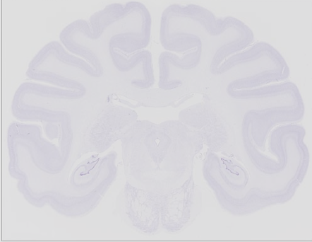 <p>stains Nissil bodies; general look of neuron; less detailed; tells if cell is alive or dead</p>