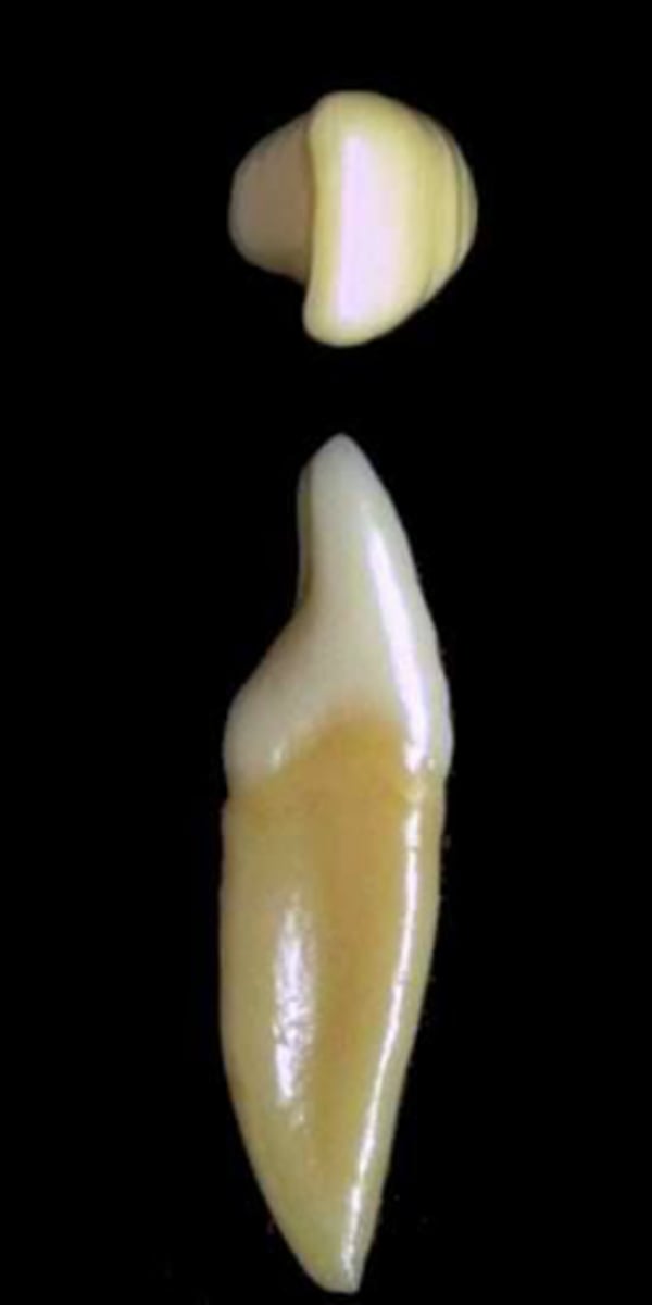 <p>what tooth is this &amp; why?</p>