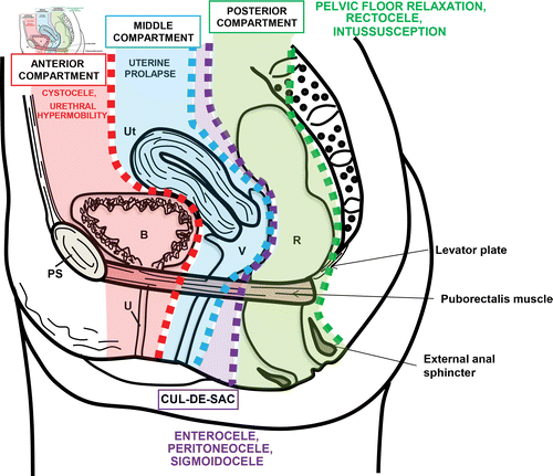 <p>Yes</p><ul><li><p><strong>anterior cul-de-sac</strong> refers to the <strong>uterovesical pouch</strong> or <strong>uterovesical space</strong></p><ul><li><p>which is the peritoneal recess between the uterus and the urinary bladder</p></li></ul></li></ul><p></p>