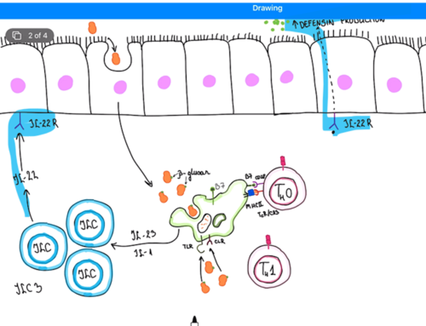 <p>- IL-22 (tā receptors ir epitēlija šūnā -> epitēlija šūnām būs ciešāka barjeras funkcija, neļaus sēnītēm iekļūt zemgļotādā)</p><p>- IL22 spēs aktivēt defensīnu produkciju -> tas veicinās sēnīšu agregātu veidošanos, lai infekcija nenokļūtu tālāk</p>