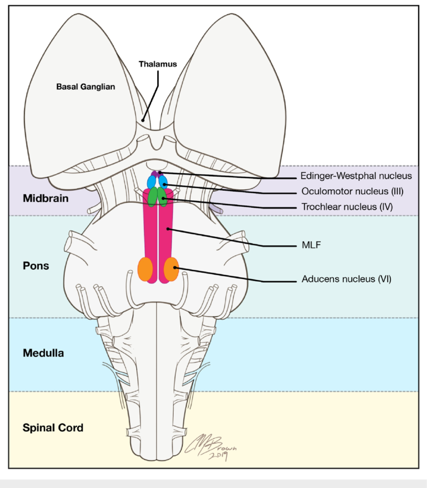 <p>Medial longitudinal fasciculus (MLF). </p>