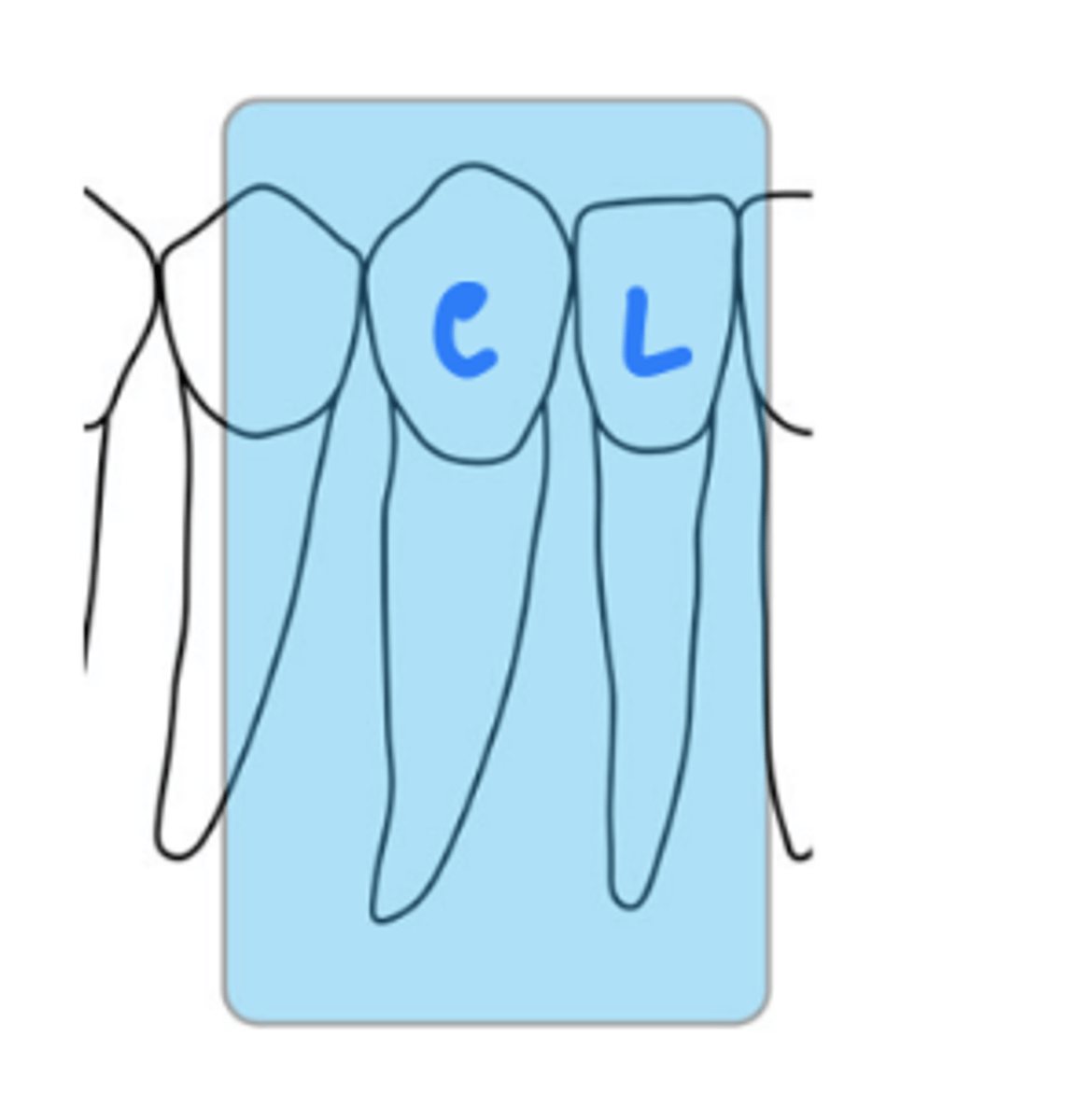 <p>size 1</p><p>canine and lateral incisor</p>