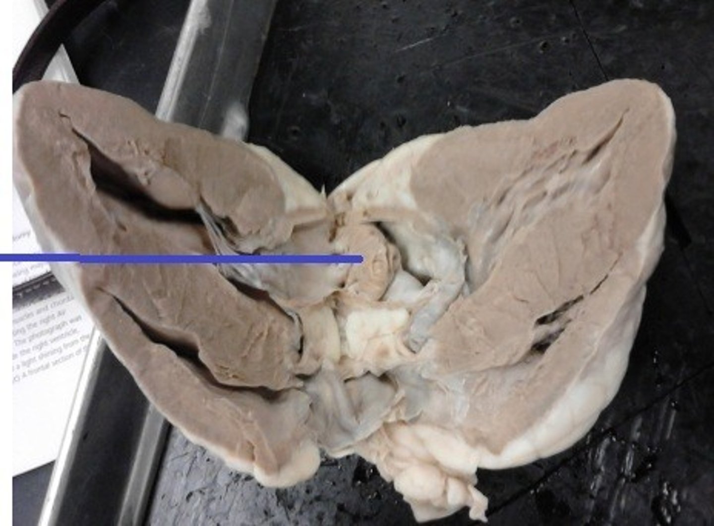 <p>Identify the valve.</p>