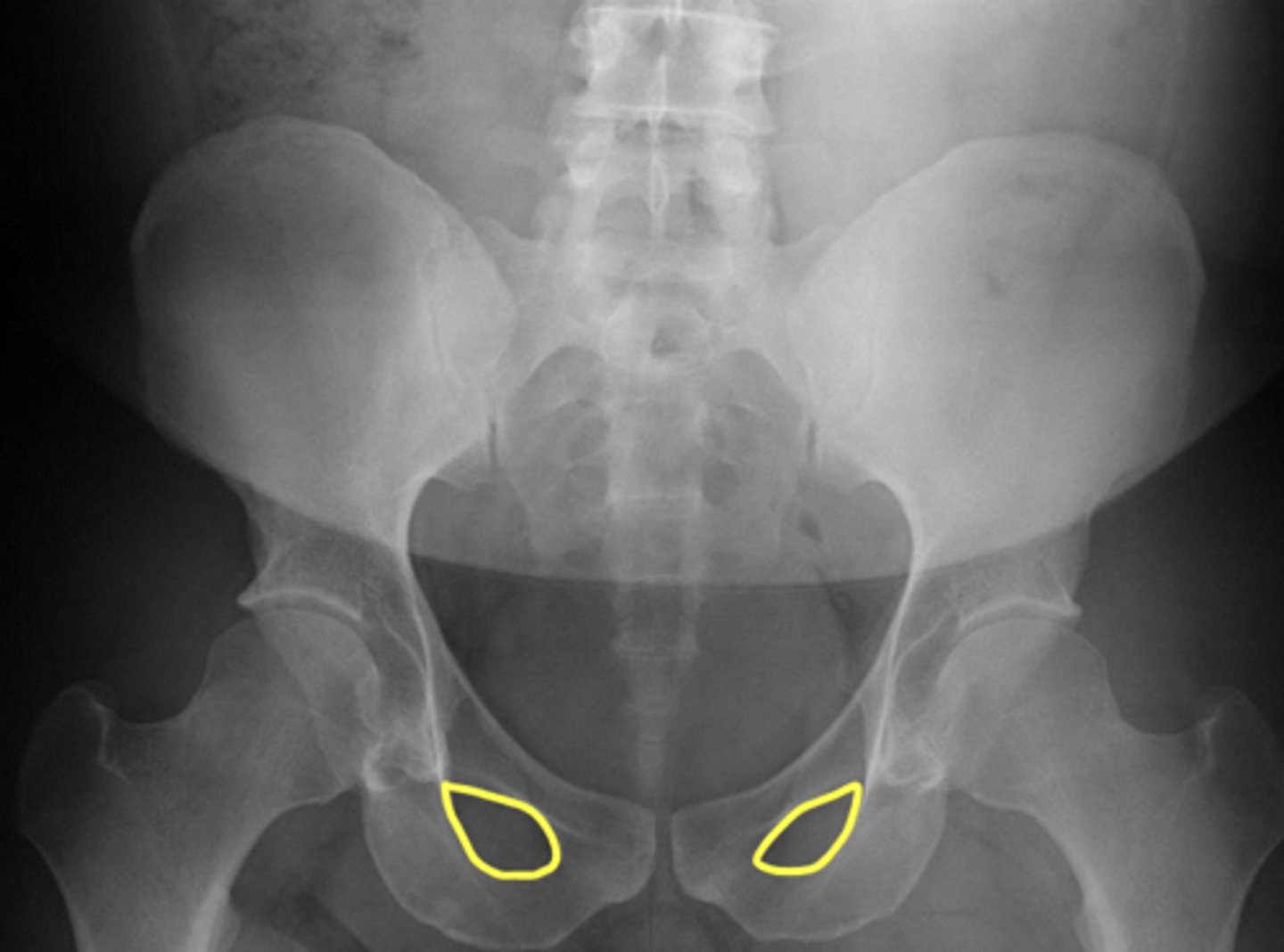 <p>What are are the yellow circles?</p>