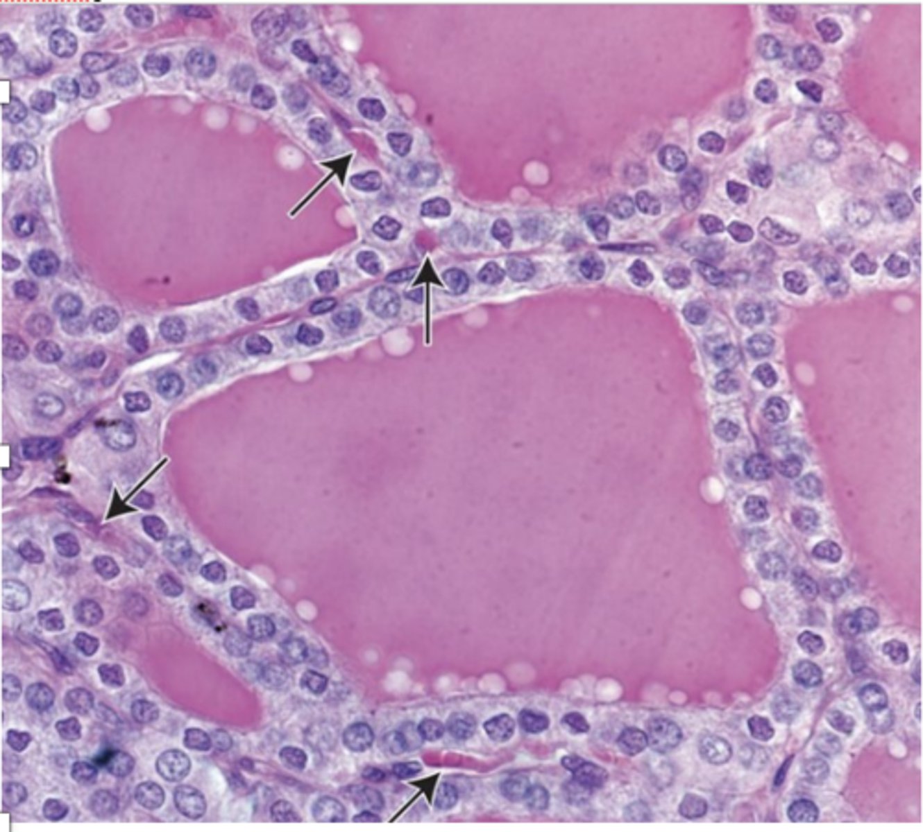 <p>What are the nuclear features of follicular cells?</p>