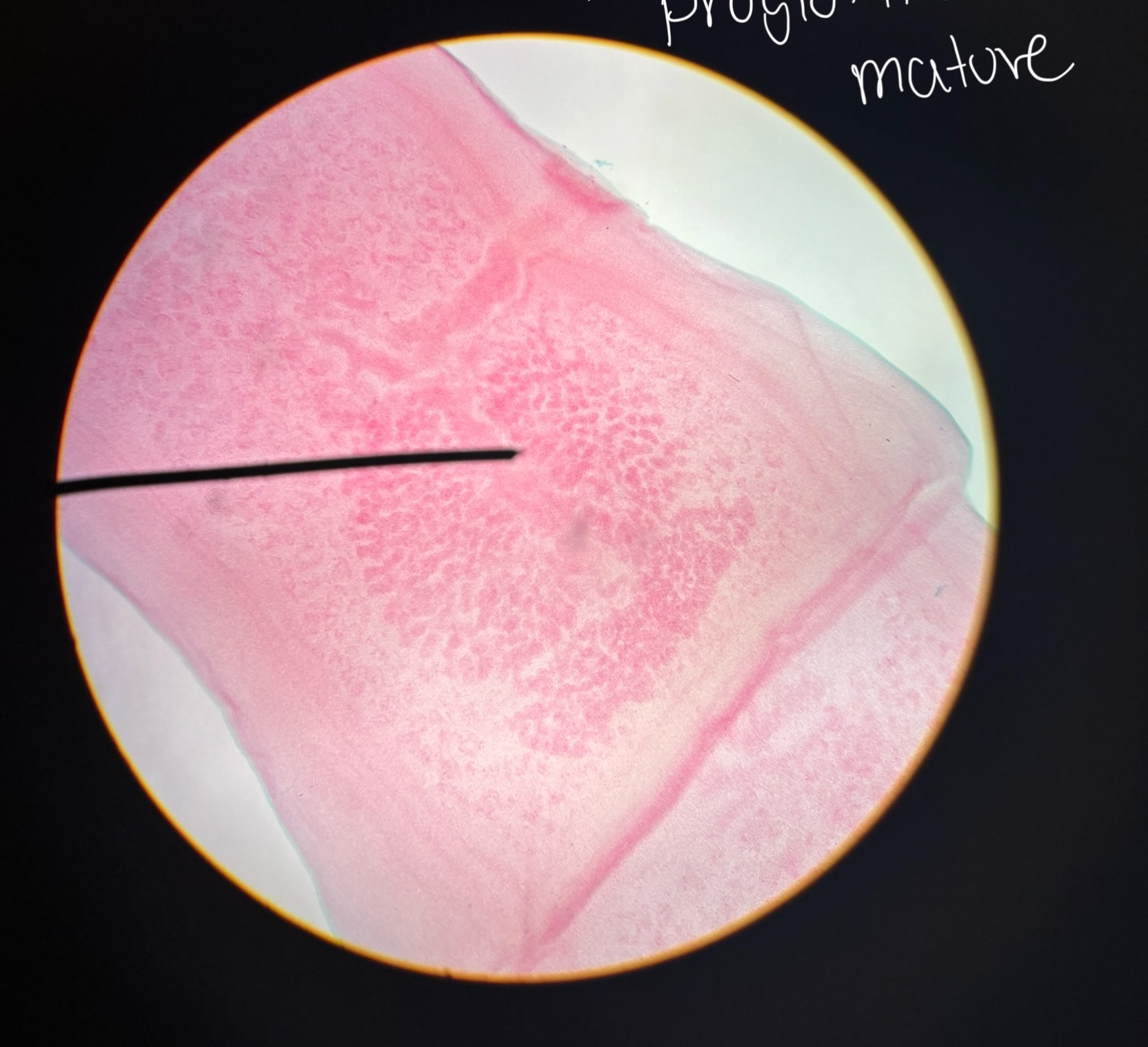 <p>This is from a rabbit life cycle, includes organs, vitellarium, gential pore, ovary, vagina, testes, uterus, and sperm duct </p>