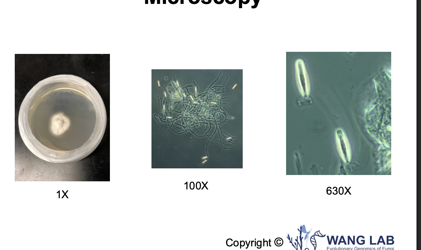 <ul><li><p><span style="background-color: inherit; line-height: 19.55px; color: windowtext;"><span>Left: fungal culture</span></span><span style="line-height: 19.55px; color: windowtext;"><span>&nbsp;</span></span></p><ul><li><p class="Paragraph  BCX0 SCXO190575521" style="text-align: left;"><span style="background-color: inherit; line-height: 19.55px; color: windowtext;"><span>Can see with naked eye</span></span><span style="line-height: 19.55px; color: windowtext;"><span>&nbsp;</span></span></p></li><li><p class="Paragraph  BCX0 SCXO190575521" style="text-align: left;"><span style="background-color: inherit; line-height: 19.55px; color: windowtext;"><span>Microbial fungi --&gt; colony formed</span></span><span style="line-height: 19.55px; color: windowtext;"><span>&nbsp;</span></span></p></li></ul></li><li><p class="Paragraph  BCX0 SCXO190575521" style="text-align: left;"><span style="background-color: inherit; line-height: 19.55px; color: windowtext;"><span>Middle: microscope</span></span><span style="line-height: 19.55px; color: windowtext;"><span>&nbsp;</span></span></p><ul><li><p class="Paragraph  BCX0 SCXO190575521" style="text-align: left;"><span style="background-color: inherit; line-height: 19.55px; color: windowtext;"><span>Colony on slide --&gt; higher structure of fungal spores and fungal hierarchy</span></span><span style="line-height: 19.55px; color: windowtext;"><span>&nbsp;</span></span></p></li></ul></li><li><p class="Paragraph  BCX0 SCXO190575521" style="text-align: left;"><span style="background-color: inherit; line-height: 19.55px; color: windowtext;"><span>630: what spores look like (aquatic microbes that infect hosts, has felangees)</span></span><span style="line-height: 19.55px; color: windowtext;"><span>&nbsp;</span></span></p></li></ul><p></p>
