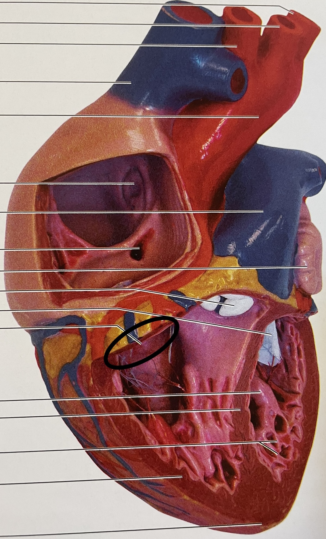 right atrium to right ventricle