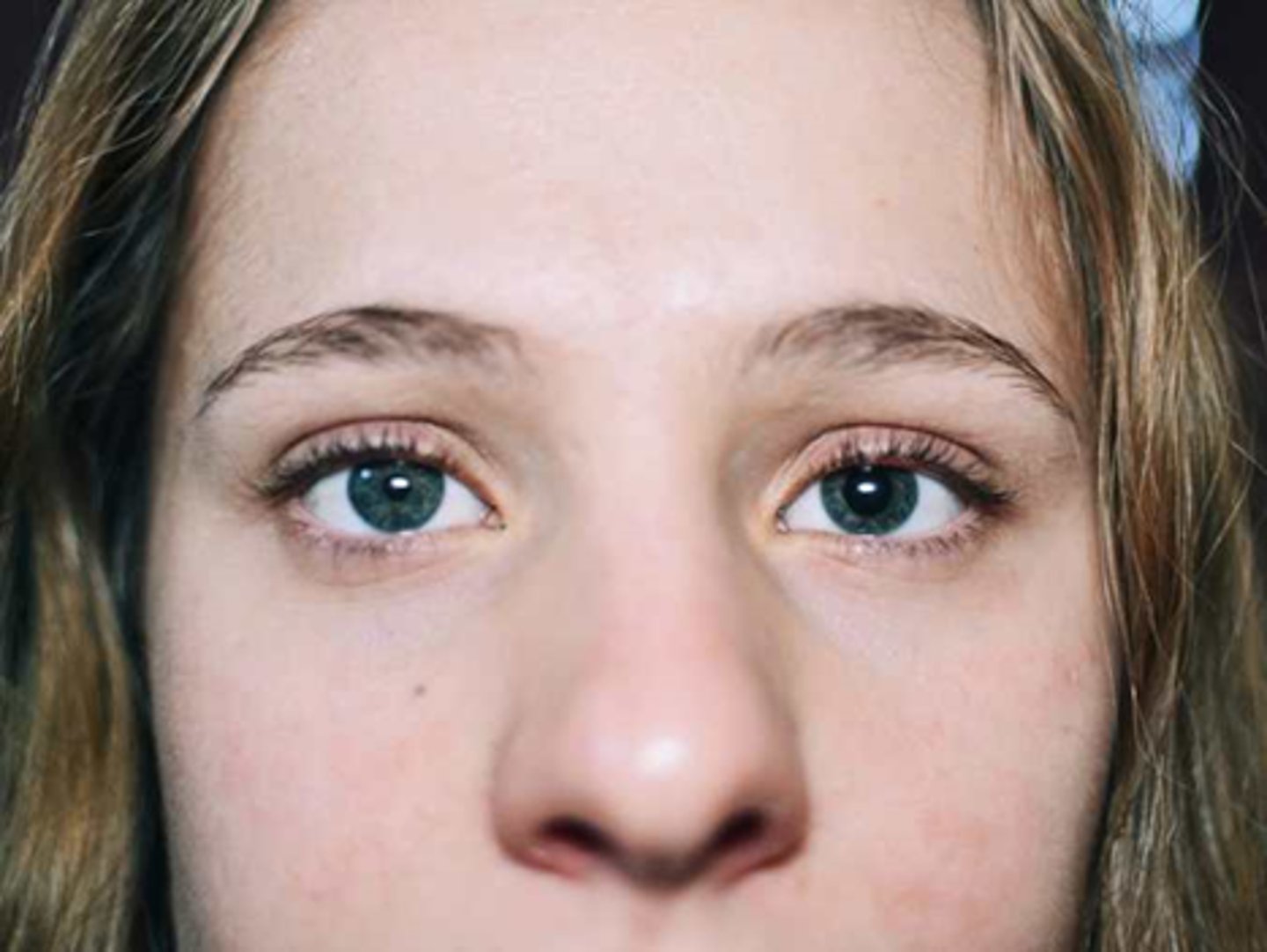 <p>indirect APD test to confirm no afferent problem with CN II</p><p>eyelid function to confirm no ptosis</p><p>EOM to confirm no palsy</p><p>iris motility observed with SLE</p><p>deep tendon reflexes</p><p>ask if always present, accom issues </p><p>pharmacolgoical supersensitivity test would be okay to do</p>