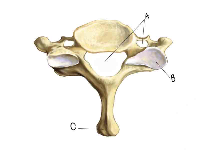 <p>What is the surface feature labeled A?</p>