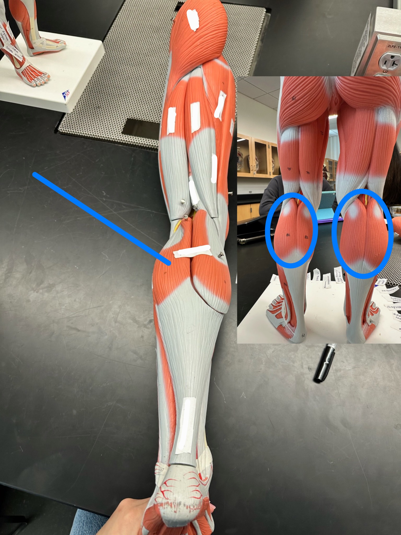 <p>ID muscle</p>