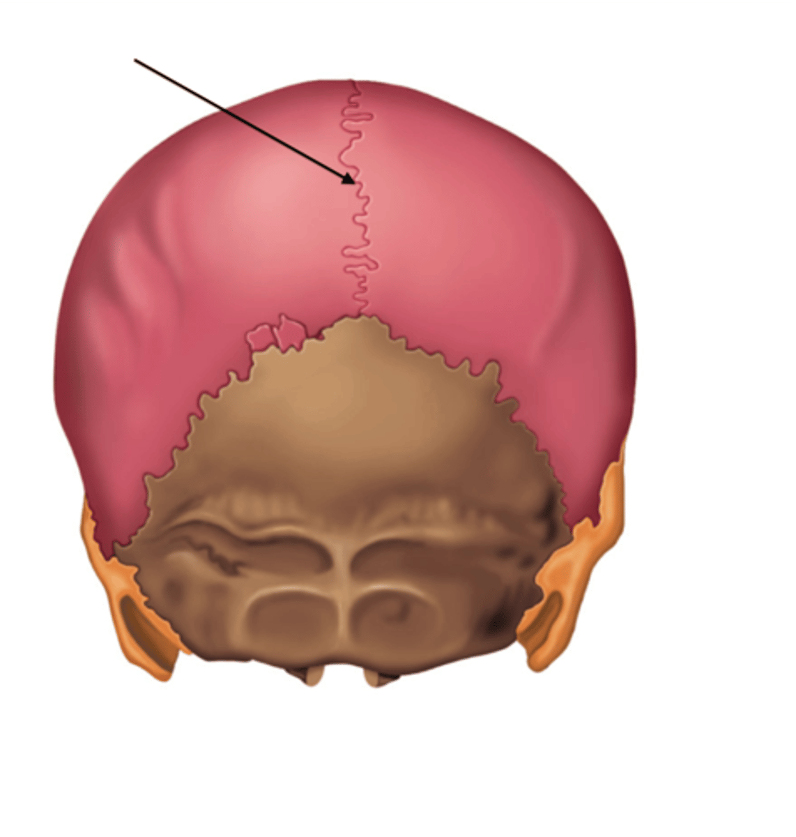 <p>ID suture at arrow</p>