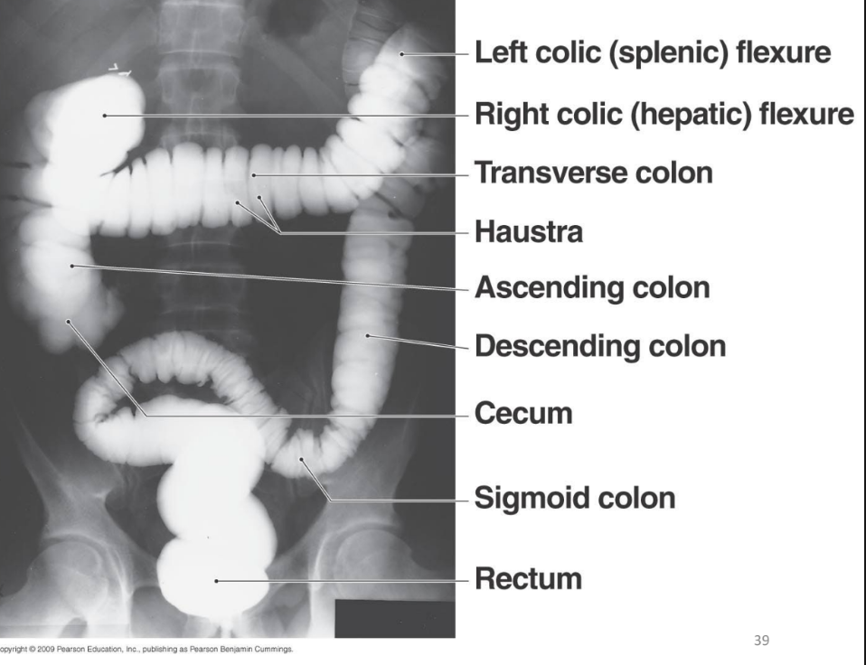 <p>the colon is not as ____ ___ ____ in an actual body</p>