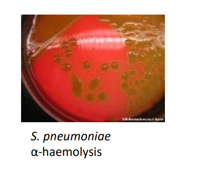 <p>no clear zone but there is a greenish tinge - haemoglobin breakdown a la bile </p>