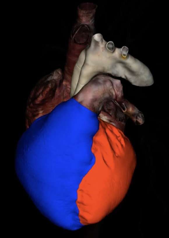 <p>What is highlighted in blue?</p>