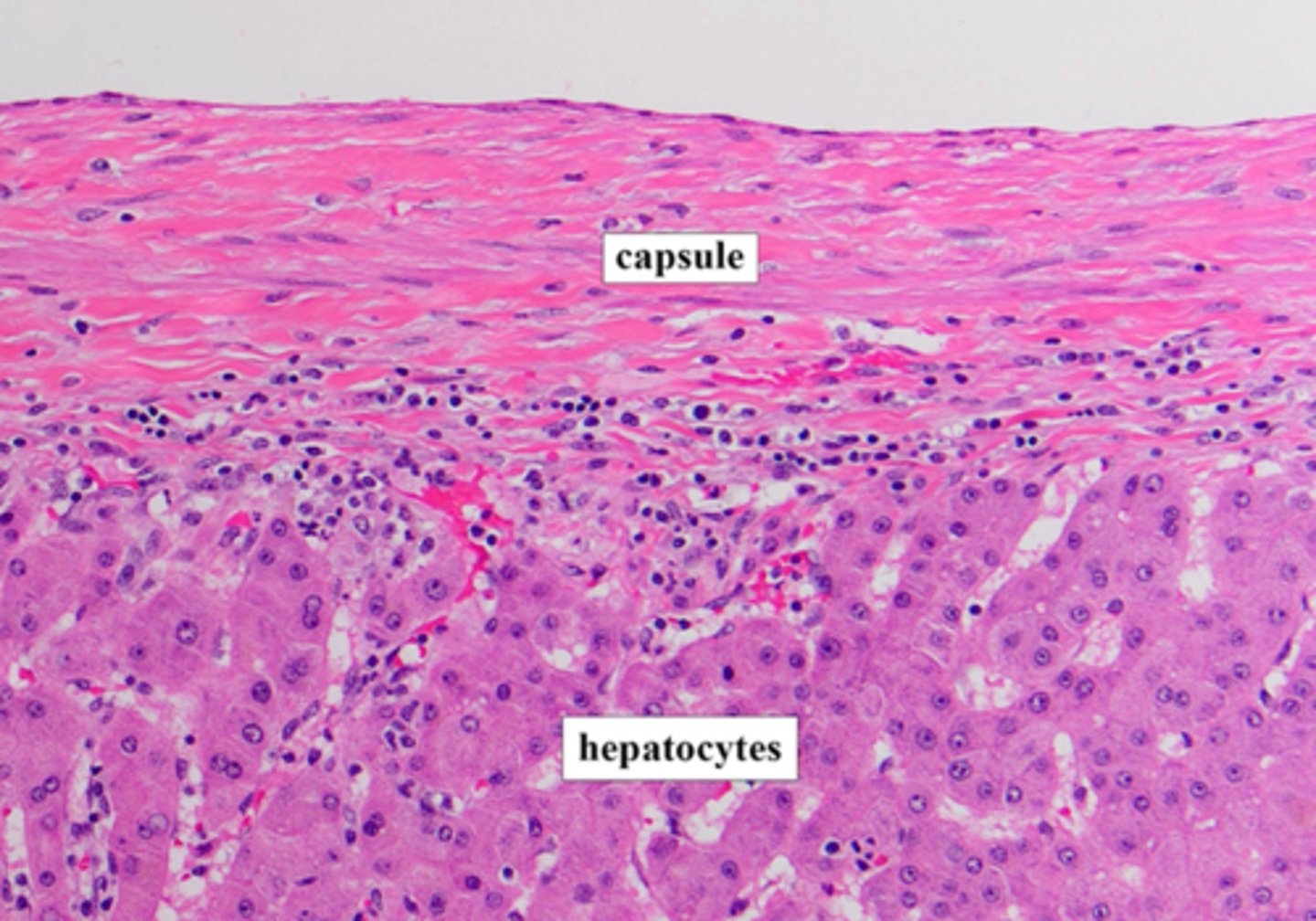 <p>The capsule is the outer surface of the liver composed of fibrous/connective tissue, covered by mesothelial cells from the peritoneum (liver: intraperitoneal).</p>