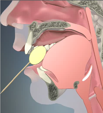 <p>Voluntary control, goal of preparing the bolus to begin digestion and transport through the swallowing mechanism </p><p>Mastication </p><p>Food is mixed with saliva to form a bolus in preparation for swallowing</p>
