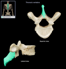 <p>A slender projection from the back of a vertebra to which muscles and ligaments are attached</p>